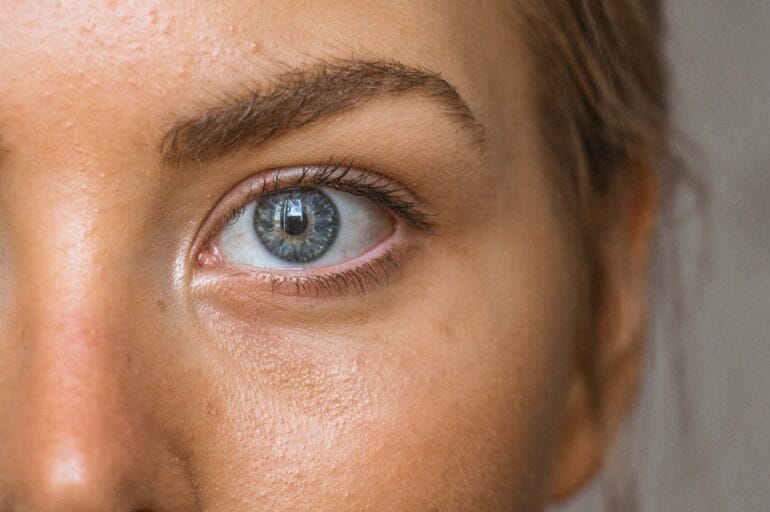 5 Common Skin Problems: Causes, Treatments, and Prevention Tips